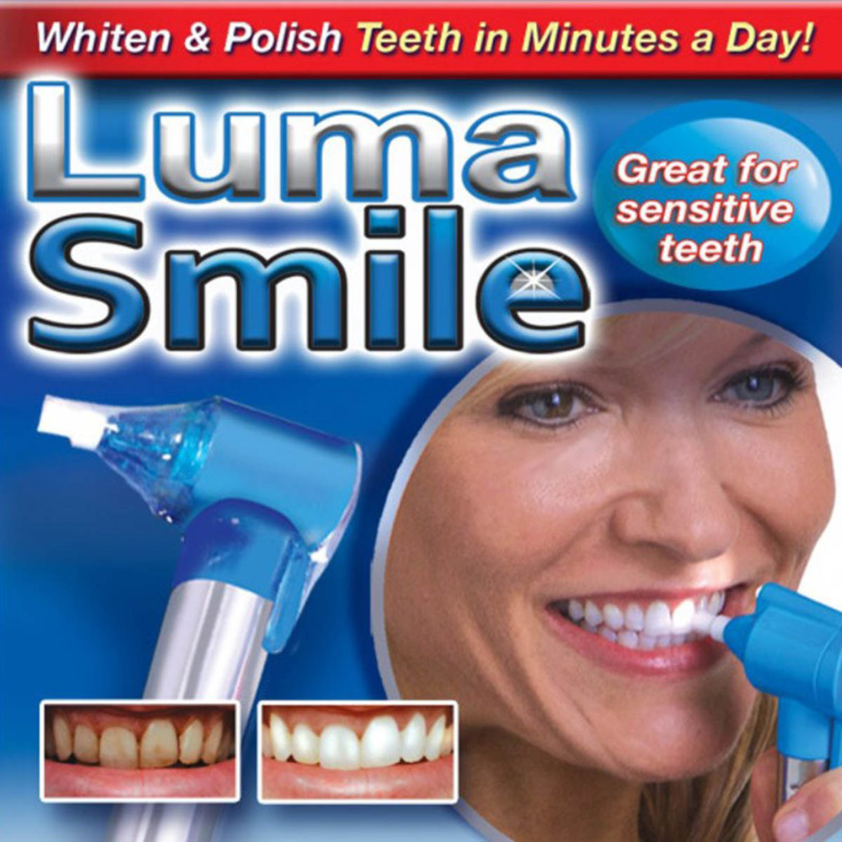 سفید کننده دندان مدل luma smile