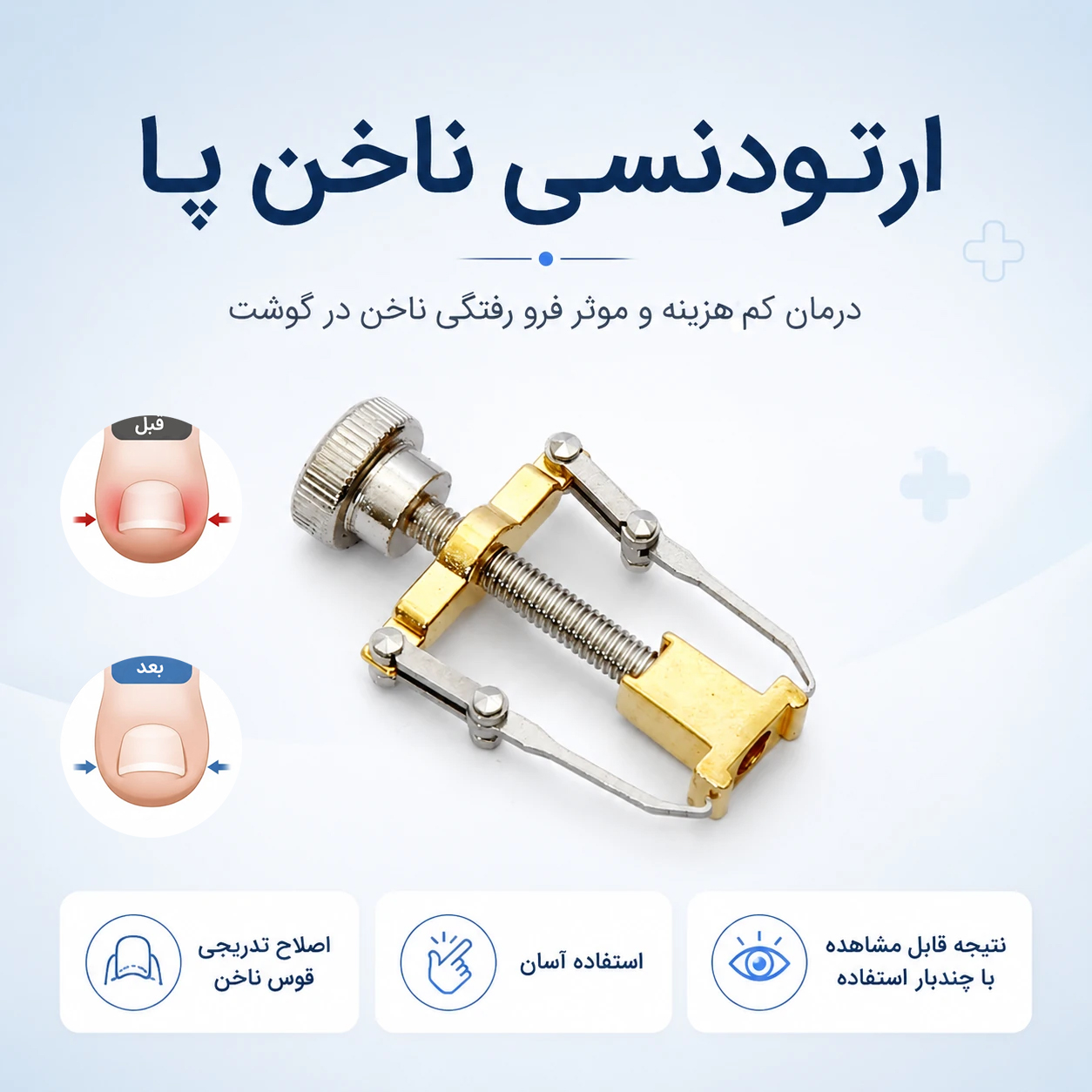 ارتودنسی ناخن