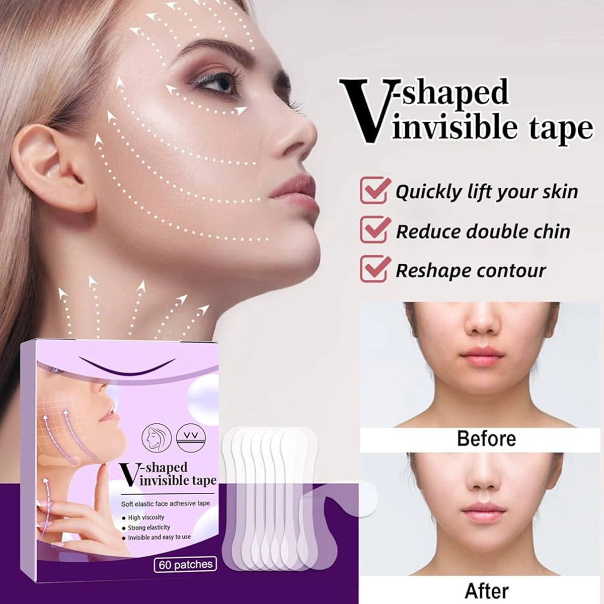 چسب اورژانسی اصلاح زاویه فک