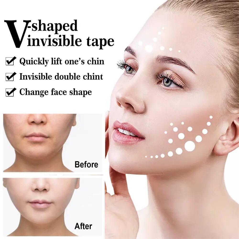 چسب اورژانسی اصلاح زاویه فک